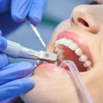 The Ultimate Guide To Tooth Cleaning: Tips For A Bright Smile