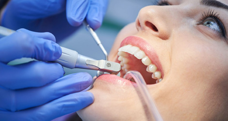 The Ultimate Guide To Tooth Cleaning: Tips For A Bright Smile